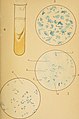 Cyclopædia of obstetrics and gynecology (1887) (14802973623).jpg
