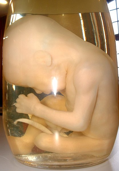 File:Human Fetus2.jpg