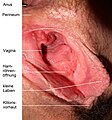 Blick auf das (intravaginal) sichtbare periurethale Schwellkörpergewebe. Die Eichel der Klitoris liegt zum Bildunterrand. Darüber die Harnröhrenmündung (Meatus urethrae externus) sie ist geschlossen und als kleine Erhebung sichtbar.