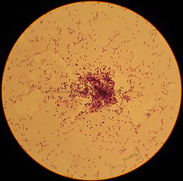 Lactobacillus acidophilus біля вагінальних епітеліальних клітин