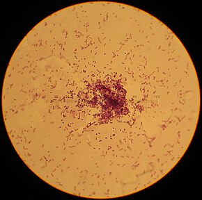 A Lactococcus_lactis.jpg kép leírása.