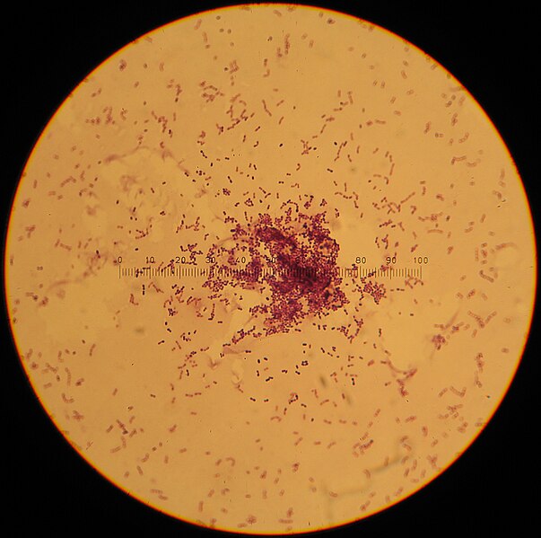 File:Lactococcus lactis.jpg