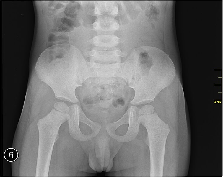 File:Medical X-Ray imaging SQB07 nevit.jpg