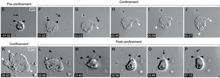 The choanoflagellate Salpingoeca rosetta can switch between a swimming (flagellate) stage and a crawling (amoeboid) stage when subjected to a confined space. Salpingoeca rosetta elife-61037-fig1-E-P.png