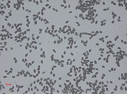 Stachybotrys Spores.jpg