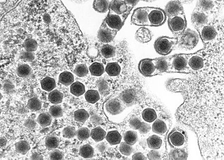 CSIRO ScienceImage 2010 Ranavirus Pathogen.jpg