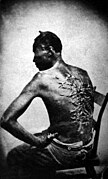 Cicatrices de flagellation sur un esclave