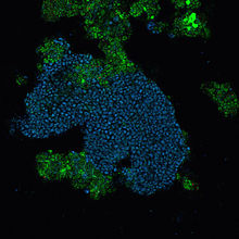 A FISH image of a floc from a lab-scale EBPR reactor. The PAOmix probe (Cy5) was used to stain "Ca. Accumulibacter phosphatis", which appear in blue EBPR FISH Floc.jpg