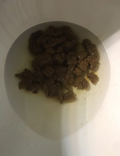 File:Fecal poop 3.jpg