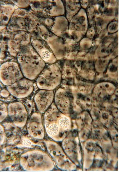 File:Gut of Daphnia magna with Glugoides intestinalis.jpg