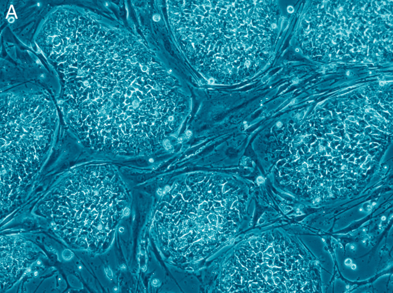 File:Human embryonic stem cells only A.png