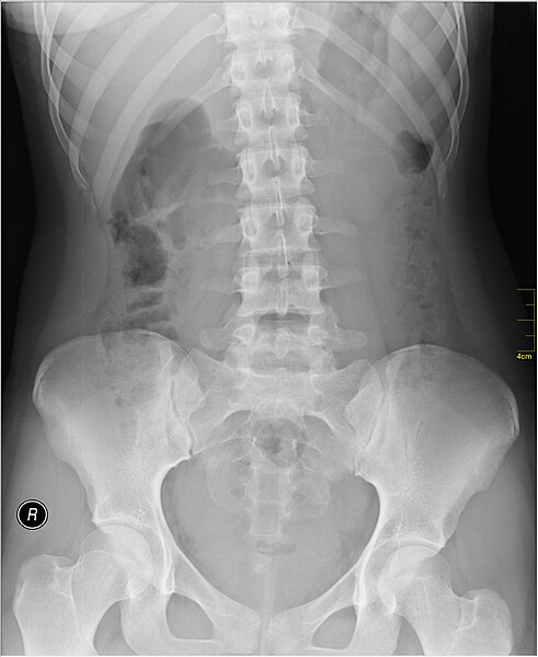 File:Medical X-Ray imaging PKZ06 nevit.jpg