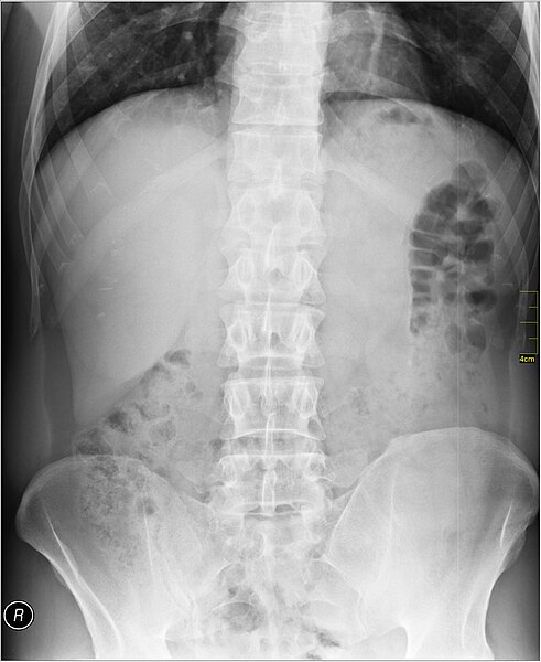 File:Medical X-Ray imaging TWM07 nevit.jpg