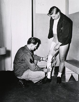 Prosthetic leg being fitted to young man Prosthetic leg being fitted to young man.jpg