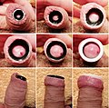Stretching the foreskin opening with flesh tunnel of different diameters