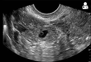 UOTW 61 - Ultrasound of the Week 1.jpg