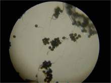 Ulocladium conidiophores 40X.png