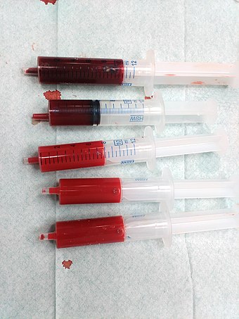 Venous and arterial blood.jpg