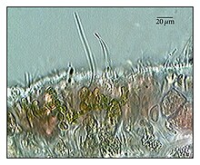 Acrochaete repens in tissues of Agarum turneri.jpg