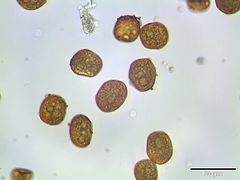 Spores of the moss Bartramia ithyphylla. (microscopic view, 400x)