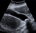 Medical Ultrasound