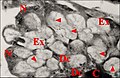 Fig.14 - Glande segmentaire rétrognathocoxale, cytologie.Dc, cellules satellites ; Ex, cavités extracellulaires ("vésicules") ; N, noyaux. Flèches :  canalicules récepteurs