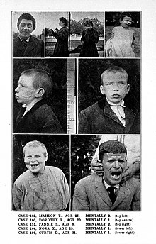 Intellectually disabled patients with 1- and 2-year-old mental ages H.H. Goddard, Feeble-mindedness; its causes and consequences Wellcome L0019567.jpg