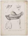 Homo sapiens - Afwijking - 1700-1880 - Print - Iconographia Zoologica - Special Collections University of Amsterdam - UBA01 IZ19600222.tif