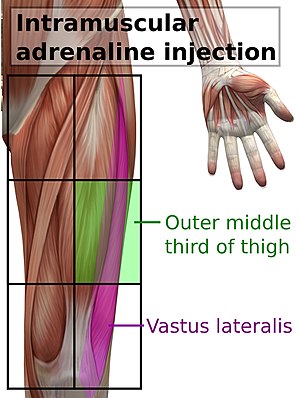 Intramuscular site of adrenaline.jpg