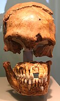 Cráneo del esqueleto conocido como Le Moustier 1, encontrado a principios de siglo XX. El resto del esqueleto se perdió en la Segunda Guerra Mundial.