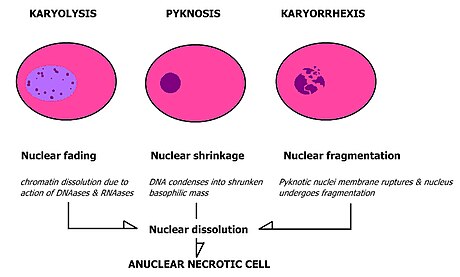 File:Nuclear changes.jpg