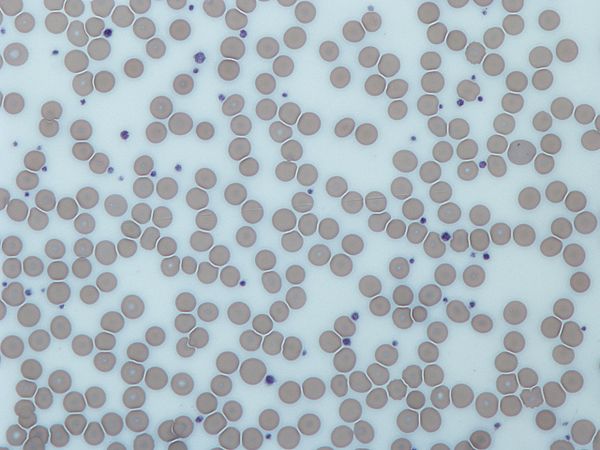 Platelets2.JPG