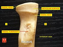 Radius.jpg