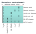Schematic of alkaline hemoglobin electrophoresis.png