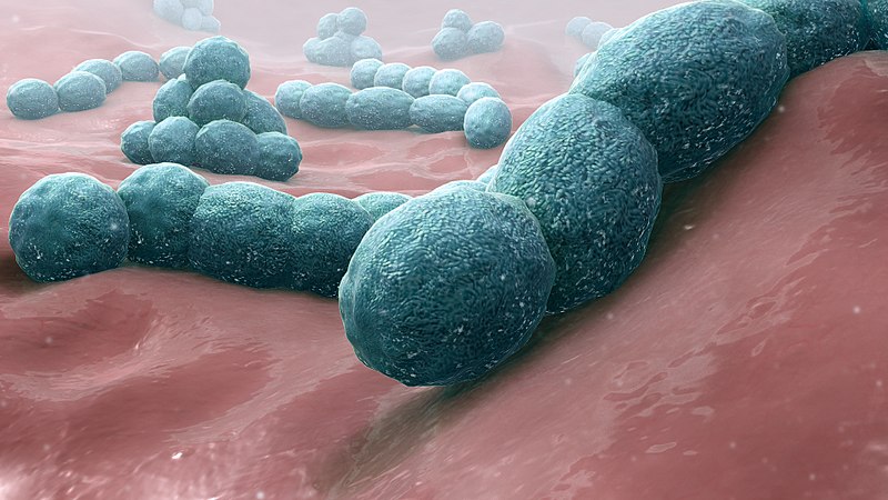 bacterial pneumonia cell