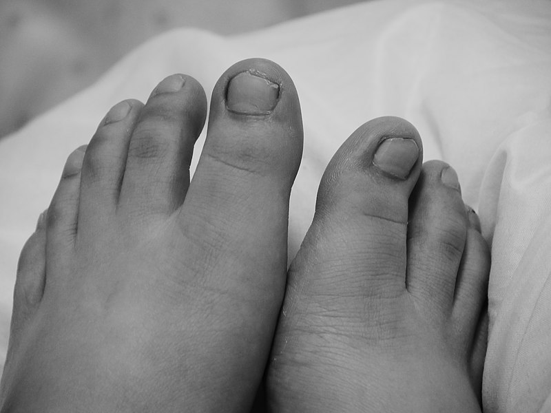 File:A pair toes in home.jpg