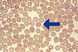 Babesia-faj