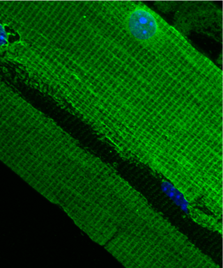 <span class="mw-page-title-main">Costamere</span> Component of striated muscle cells
