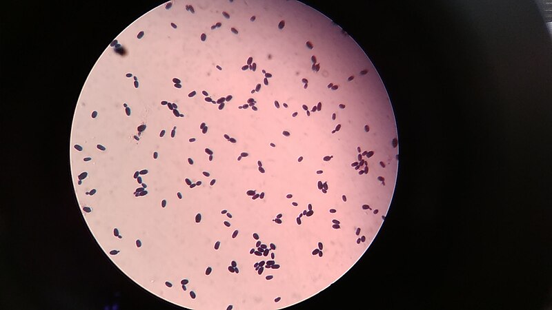 File:Gram positive yeast cells in Gram staining of culture.jpg