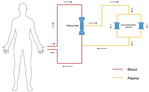 Immunoadsorption schematic Immunoadsoption schematic.png