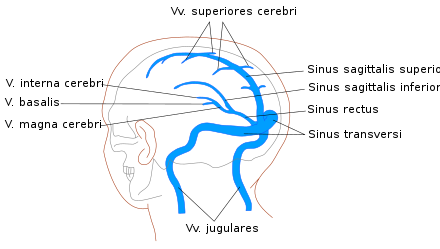 Zerebrale Venen- Und Sinusthrombose: Begriffe, Häufigkeit, Ursachen und Risikofaktoren
