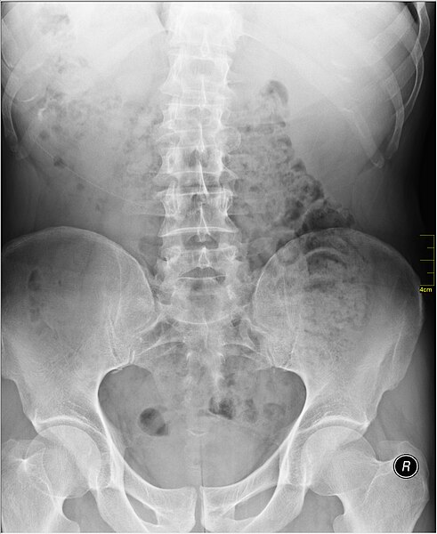 File:Medical X-Ray imaging CUJ03 nevit.jpg