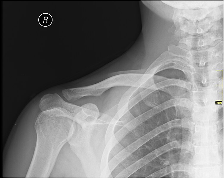 File:Medical X-Ray imaging IXX05 nevit.jpg