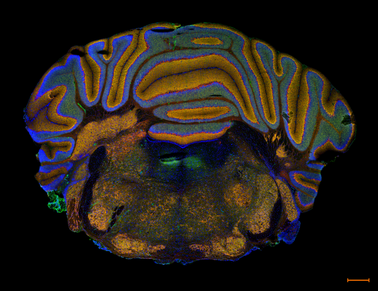 File:Mouse auditory brainstem Kv3.1 and Kv3.3 channels K Bondarenko.png