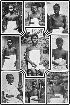 Сечене руке женама и деци радника који нису нису испунили квоту код производње гуме, Белгијски Конго.