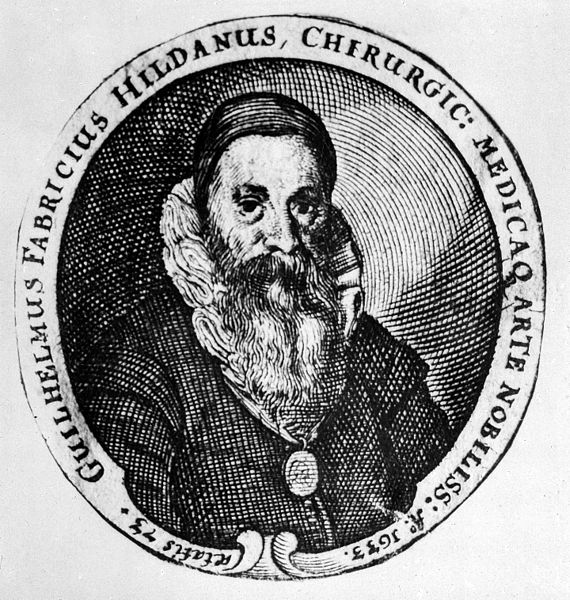 File:Portrait of Gulielmus Fabricius Hildanus (1560-1634) Wellcome M0010132.jpg