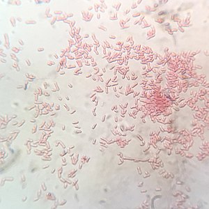 Shigella flexneri Gram Stain on Microscope Slide.jpg