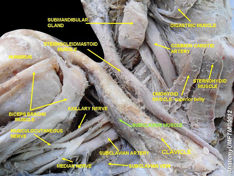 File:Slide10d.JPG