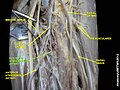 Posterior interosseous artery