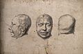 Three perspectives of the death-mask of Maria Manning, the m Wellcome V0009463.jpg